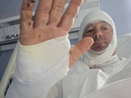 Arrestata a Catania la donna che ha sfregiato un avvocato con l’acido: è accusata di lesioni aggravate